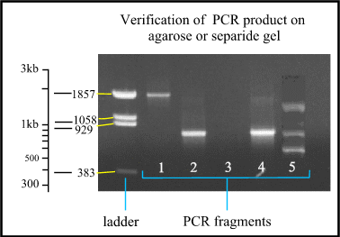 PCR gel